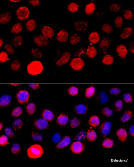 Immunohistochemistry of paraffin-embedded Human mammary cancer using CCNB1 Polyclonal Antibody at dilution of 1:100 (40x lens).