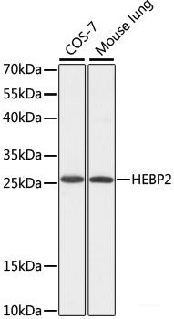 Immunofluorescence analysis of Rat spleen using CD70 Polyclonal Antibody at dilution of 1:100. Blue: DAPI for nuclear staining.