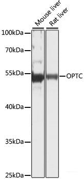 Western blot analysis of extracts of various cell lines using DNMT1 Polyclonal Antibody at dilution of 1:1000.