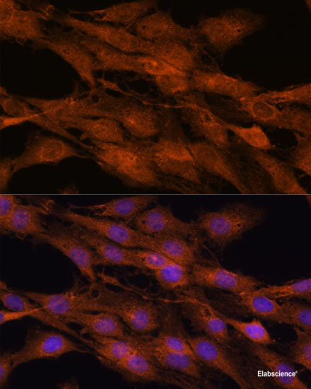 Immunofluorescence analysis of HeLa cells using EGFR Polyclonal Antibody at dilution of 1:100. Blue: DAPI for nuclear staining.