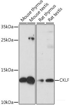 Immunofluorescence analysis of U-2 OS cells using ACSL4 Polyclonal Antibody at dilution of 1:100. Blue: DAPI for nuclear staining.
