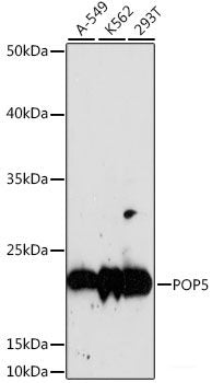 Immunohistochemistry of paraffin-embedded Human lung cancer using NR5A2 Polyclonal Antibody at dilution of 1:100 (40x lens).