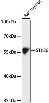 Immunohistochemistry of paraffin-embedded Human lung cancer using GAB1 Polyclonal Antibody at dilution of 1:100 (40x lens).