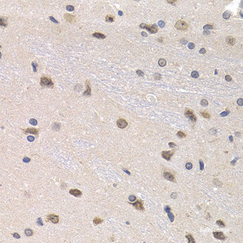 Immunohistochemistry of paraffin-embedded Mouse brain using GAP43 Polyclonal Antibody at dilution of 1:100 (40x lens).