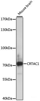 Immunofluorescence analysis of L-929 cells using GLI2 Polyclonal Antibody at dilution of 1:100. Blue: DAPI for nuclear staining.