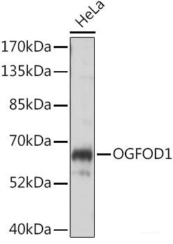 Immunohistochemistry of paraffin-embedded Human liver cancer using HIF1A Polyclonal Antibody at dilution of 1:200 (40x lens).