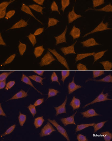 Immunohistochemistry of paraffin-embedded Human colon using HMGCR Polyclonal Antibody at dilution of 1:200 (40x lens).