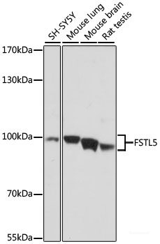 Immunofluorescence analysis of NIH/3T3 cells using HMGCR Polyclonal Antibody at dilution of 1:100. Blue: DAPI for nuclear staining.