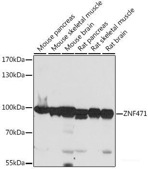 Western blot analysis of extracts of H460 cells using T Polyclonal Antibody at dilution of 1:1000.
