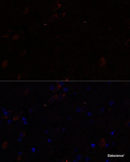 Immunohistochemistry of paraffin-embedded Rat heart using CD59 Polyclonal Antibody at dilution of 1:100 (40x lens).