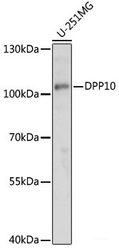 Immunohistochemistry of paraffin-embedded Human liver cancer using COL1A1 Polyclonal Antibody at dilution of 1:200 (40x lens).