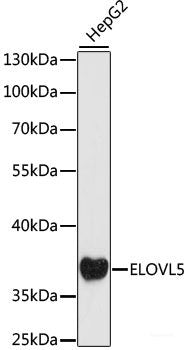 Immunohistochemistry of paraffin-embedded Human colon carcinoma using TOM20 Polyclonal Antibody at dilution of 1:100 (40x lens).