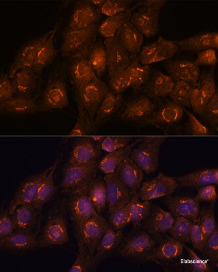 Immunofluorescence analysis of U2OS cells using EWSR1 Polyclonal Antibody at dilution of 1:100. Blue: DAPI for nuclear staining.