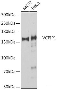 Immunofluorescence analysis of Mouse brain using KCNA1 Polyclonal Antibody at dilution of 1:100. Blue: DAPI for nuclear staining.
