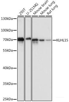 Western blot analysis of extracts of various cell lines using F12 Polyclonal Antibody at dilution of 1:1000.