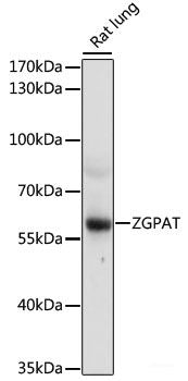 Immunohistochemistry of paraffin-embedded Rat brain using MAG Polyclonal Antibody at dilution of 1:200 (40x lens).