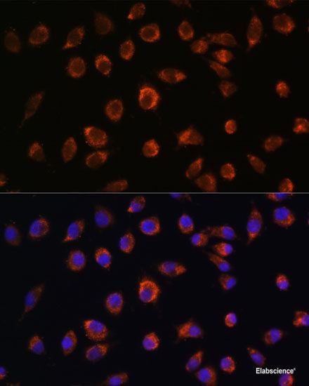 Western blot analysis of extracts of various cell lines using NAIP Polyclonal Antibody at dilution of 1:1000.