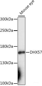 Immunohistochemistry of paraffin-embedded Mouse brain using NEUROD1 Polyclonal Antibody at dilution of 1:200 (40x lens).
