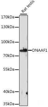 Immunofluorescence analysis of HeLa cells using UGT2B7 Polyclonal Antibody at dilution of 1:100 (40x lens). Blue: DAPI for nuclear staining.