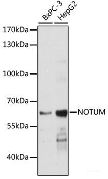Western blot analysis of extracts of Mouse heart using CDK7 Polyclonal Antibody at dilution of 1:1000.