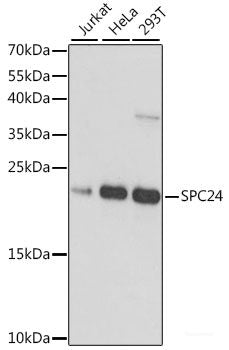 Immunofluorescence analysis of NIH-3T3 cells using PAK3 Polyclonal Antibody at dilution of 1:100. Blue: DAPI for nuclear staining.