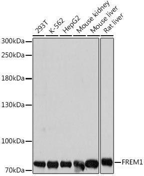 Immunohistochemistry of paraffin-embedded Rat spleen using AMPKα1 Polyclonal Antibody at dilution of 1:200 (40x lens).
