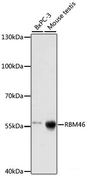 Immunofluorescence analysis of U-2 OS cells using Rb Polyclonal Antibody at dilution of 1:100. Blue: DAPI for nuclear staining.