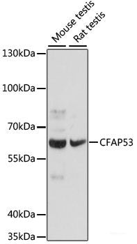 Western blot analysis of extracts of various cell lines using RPL18A Polyclonal Antibody at dilution of 1:1000.