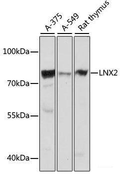 Western blot analysis of extracts of various cell lines using KIR2DL1 Polyclonal Antibody at dilution of 1:1000.