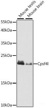 Immunohistochemistry of paraffin-embedded Mouse spinal cord using THBS1 Polyclonal Antibody at dilution of 1:200 (40x lens).