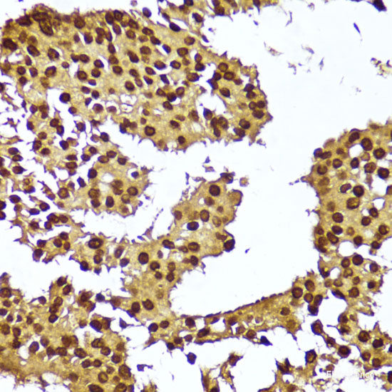Immunohistochemistry of paraffin-embedded Rat brain using THY1 Polyclonal Antibody at dilution of 1:100 (40x lens).