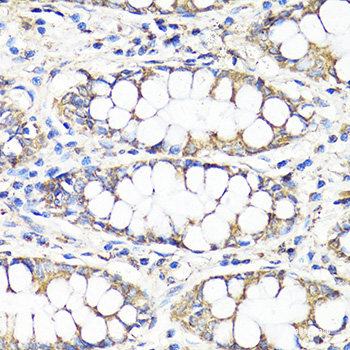 Immunofluorescence analysis of C6 cells using UCP3 Polyclonal Antibody at dilution of 1:100. Blue: DAPI for nuclear staining.