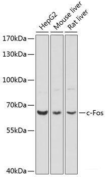 Immunohistochemistry of paraffin-embedded Rat lung using SCGB1A1 Polyclonal Antibody at dilution of 1:100 (40x lens).