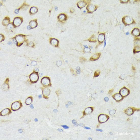 Immunohistochemistry of paraffin-embedded Rat lung using SCGB1A1 Polyclonal Antibody at dilution of 1:100 (40x lens).