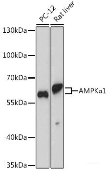 Immunohistochemistry of paraffin-embedded Human liver using GLA Polyclonal Antibody at dilution of 1:100 (40x lens).