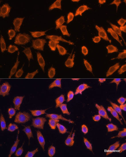 Immunohistochemistry of paraffin-embedded Human colon carcinoma using VIL1 Polyclonal Antibody at dilution of 1:100 (40x lens).