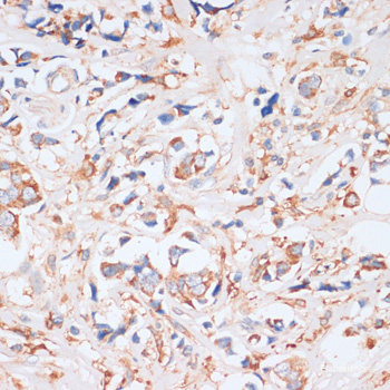 Immunohistochemistry of paraffin-embedded Rat heart using ARHGEF5 Polyclonal Antibody at dilution of 1:100 (40x lens).