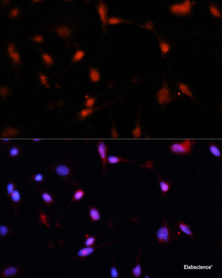 Western blot analysis of extracts of various cell lines using CEACAM1 Polyclonal Antibody at dilution of 1:1000.