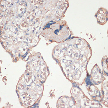 Immunohistochemistry of paraffin-embedded Human tonsil using TNFSF11 Polyclonal Antibody at dilution of 1:200 (40x lens).