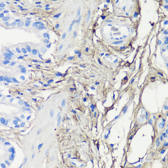 Immunofluorescence analysis of C6 cells using BECN1 Polyclonal Antibody at dilution of 1:100. Blue: DAPI for nuclear staining.