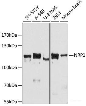 Western blot analysis of extracts of Mouse kidney using CD9 Polyclonal Antibody at dilution of 1:1000.