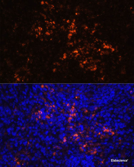 Immunofluorescence analysis of C6 cells using RAB11A Polyclonal Antibody at dilution of 1:100. Blue: DAPI for nuclear staining.