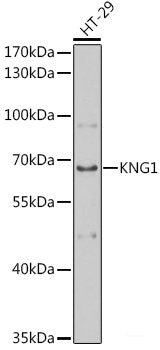 Immunofluorescence analysis of U-2 OS cells using SOCS2 Polyclonal Antibody at dilution of 1:100 (40x lens). Blue: DAPI for nuclear staining.