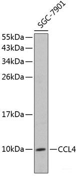Immunohistochemistry of paraffin-embedded Human lung cancer using TAX1BP1 Polyclonal Antibody at dilution of 1:100 (40x lens).
