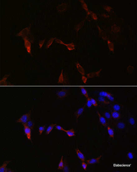 Western blot analysis of extracts of various cell lines using CFL1 Polyclonal Antibody at dilution of 1:3000.