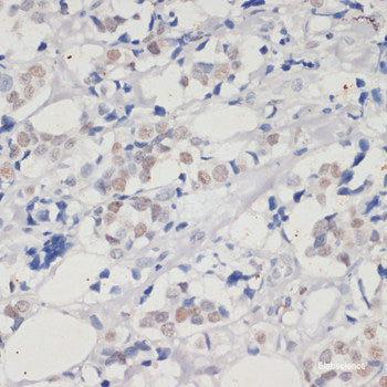 Immunofluorescence analysis of C6 cells using KEAP1 Polyclonal Antibody at dilution of 1:100. Blue: DAPI for nuclear staining.