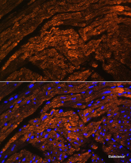 Immunohistochemistry of paraffin-embedded Human mammary cancer using NR1I3 Polyclonal Antibody at dilution of 1:200 (40x lens).
