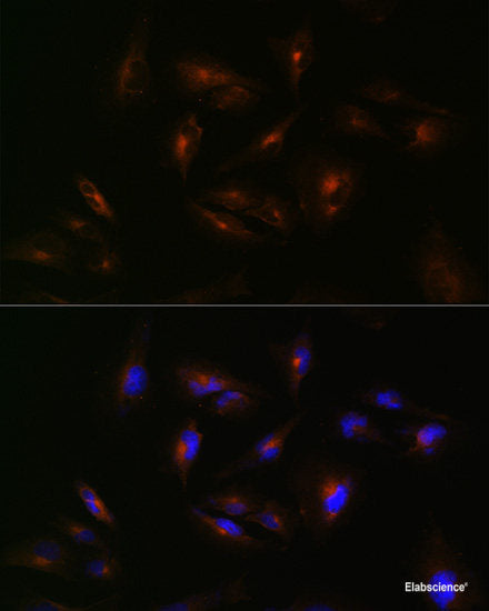 Western blot analysis of extracts of Mouse brain using CTBP1 Polyclonal Antibody at dilution of 1:1000.