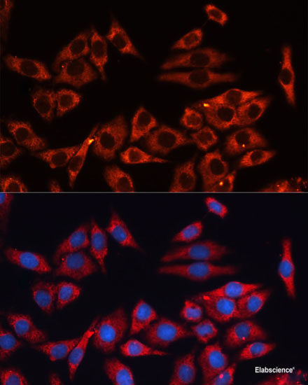 Immunohistochemistry of paraffin-embedded Rat liver using ARL4A Polyclonal Antibody at dilution of 1:100 (40x lens).