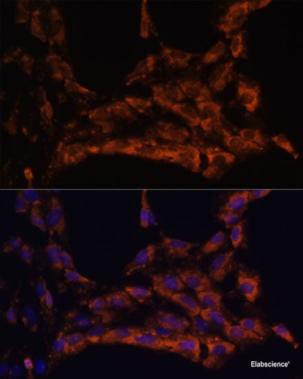 Western blot analysis of extracts of various cell lines using TUBB3 Polyclonal Antibody at dilution of 1:1000.